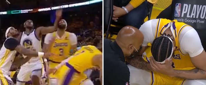 Anthony Davis Left Game 5 Of Lakers-Warriors After An Elbow To The Face From Kevon Looney